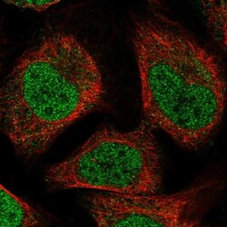 MBD6 Antibody, Novus Biologicals 0.1mL; Unlabeled:Antibodies, Polyclonal